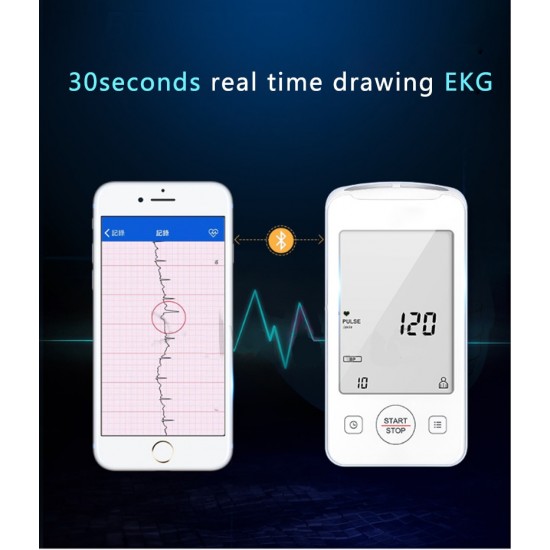 Tlakomer s funkciou merania EKG - spárovateľný s IOS a Android OS smartfónmi